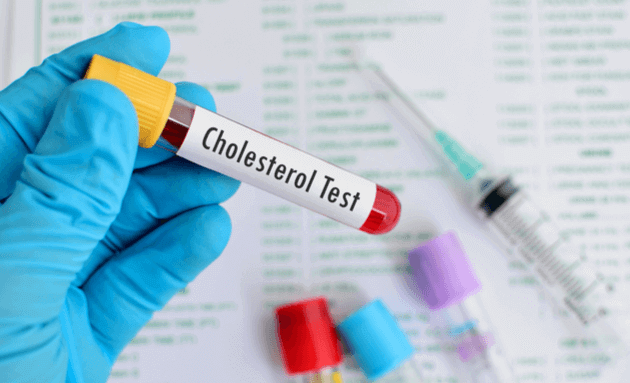 Teste de colesterol