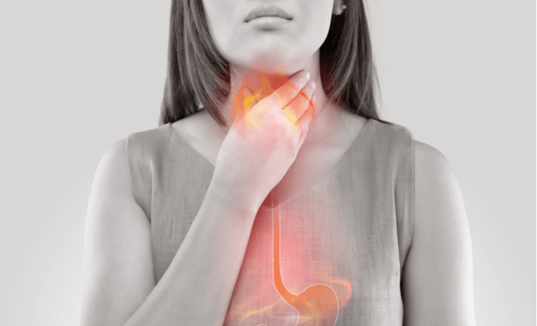 is-it-heartburn-or-gastroesophageal-reflux-disease-gerd