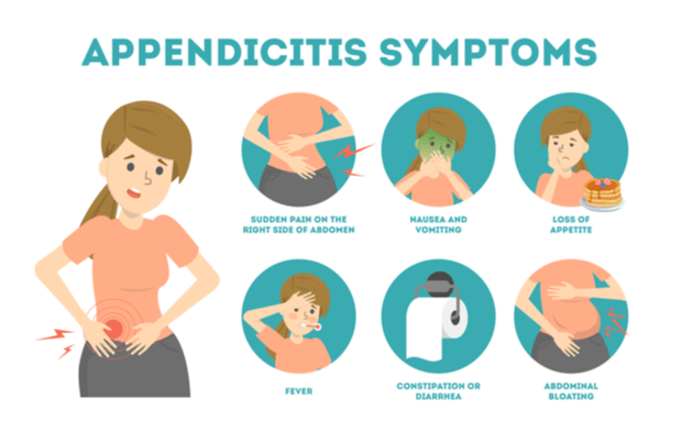 Appendicitis-Symptoms