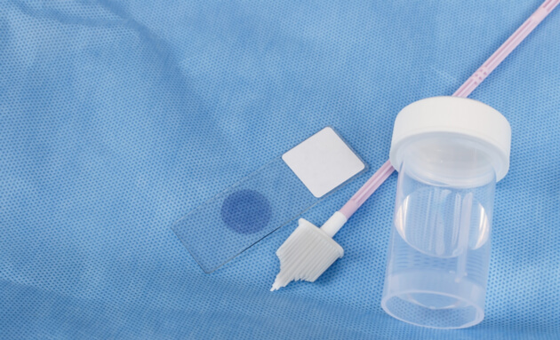 Pap-Smear-Test-Implements