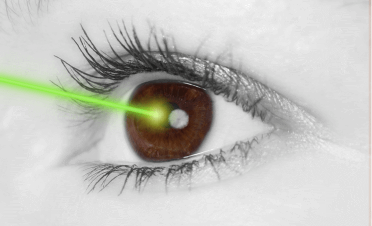 what-you-should-know-about-lasik-eye-surgery