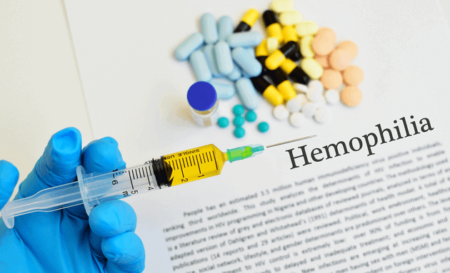 treatment options for haemophilia