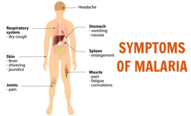 Malaria-Symptoms-1