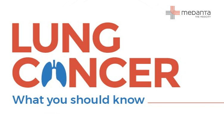 lung-cancer-what-you-should-know