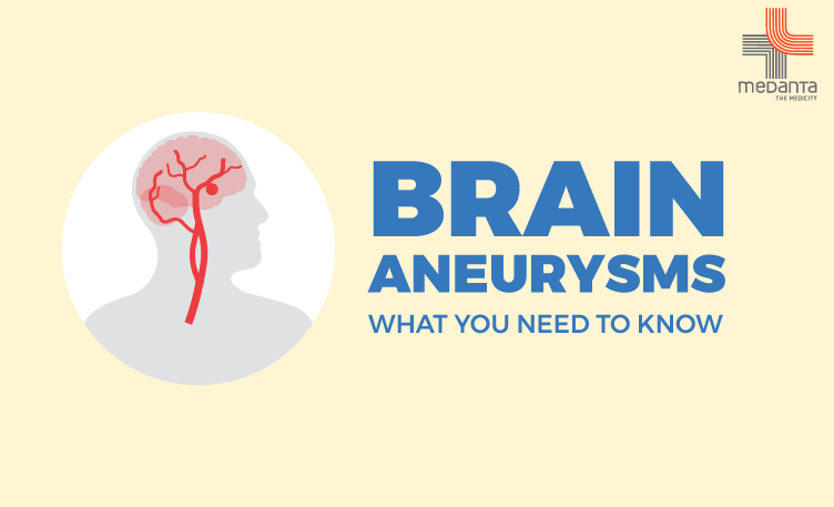 Medanta | All You Need To Know About Brain Aneurysms