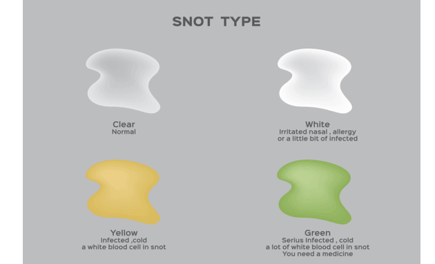 Types of Snot -  Medanta