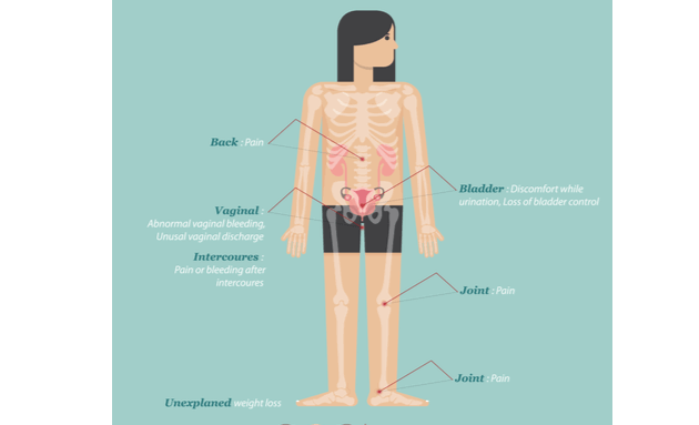 Cervical cancer signs of 10 Cervical cancer