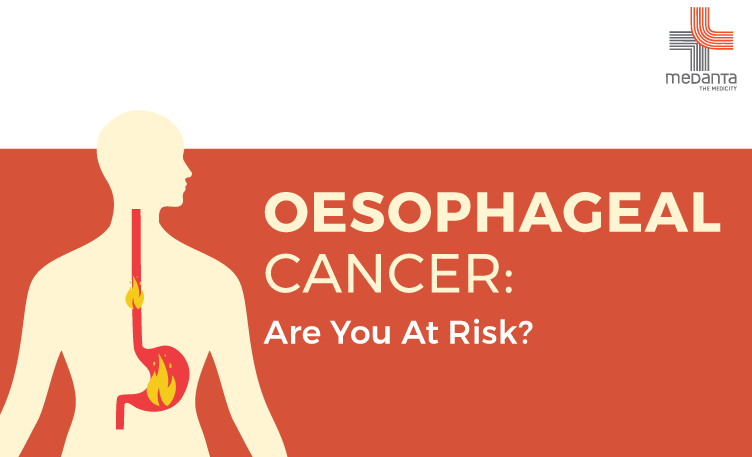 oesophageal-cancer---know-your-risk