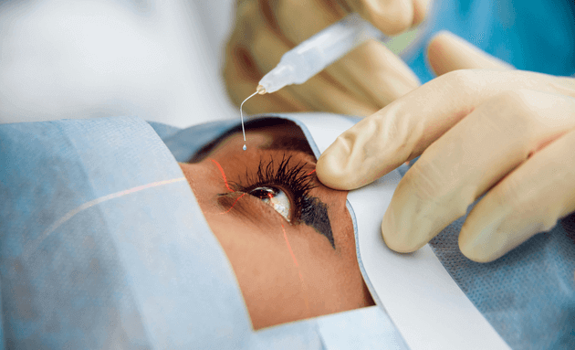 During-Eye-Surgery