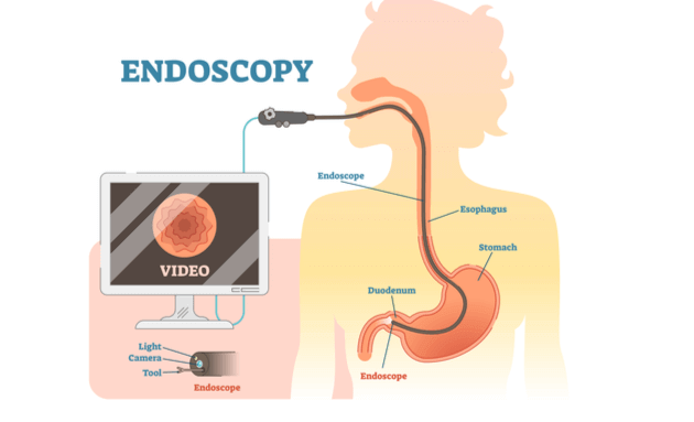How-does-endoscopy-work