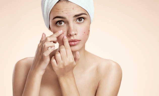 What-causes-acne-in-teens
