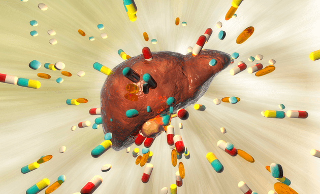 Drug-induced-liver-injury