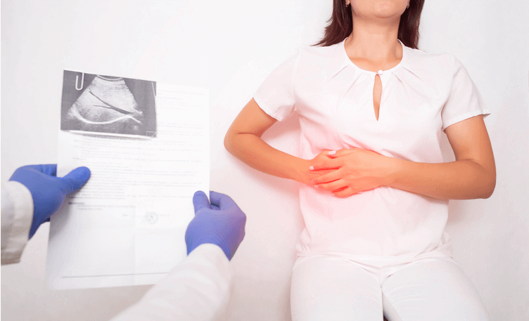6-ways-to-prevent-gall-bladder-stone