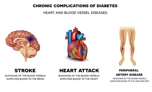 relationship between diabetes and heart disease)
