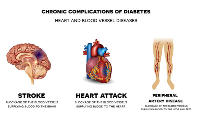 Heart-disease