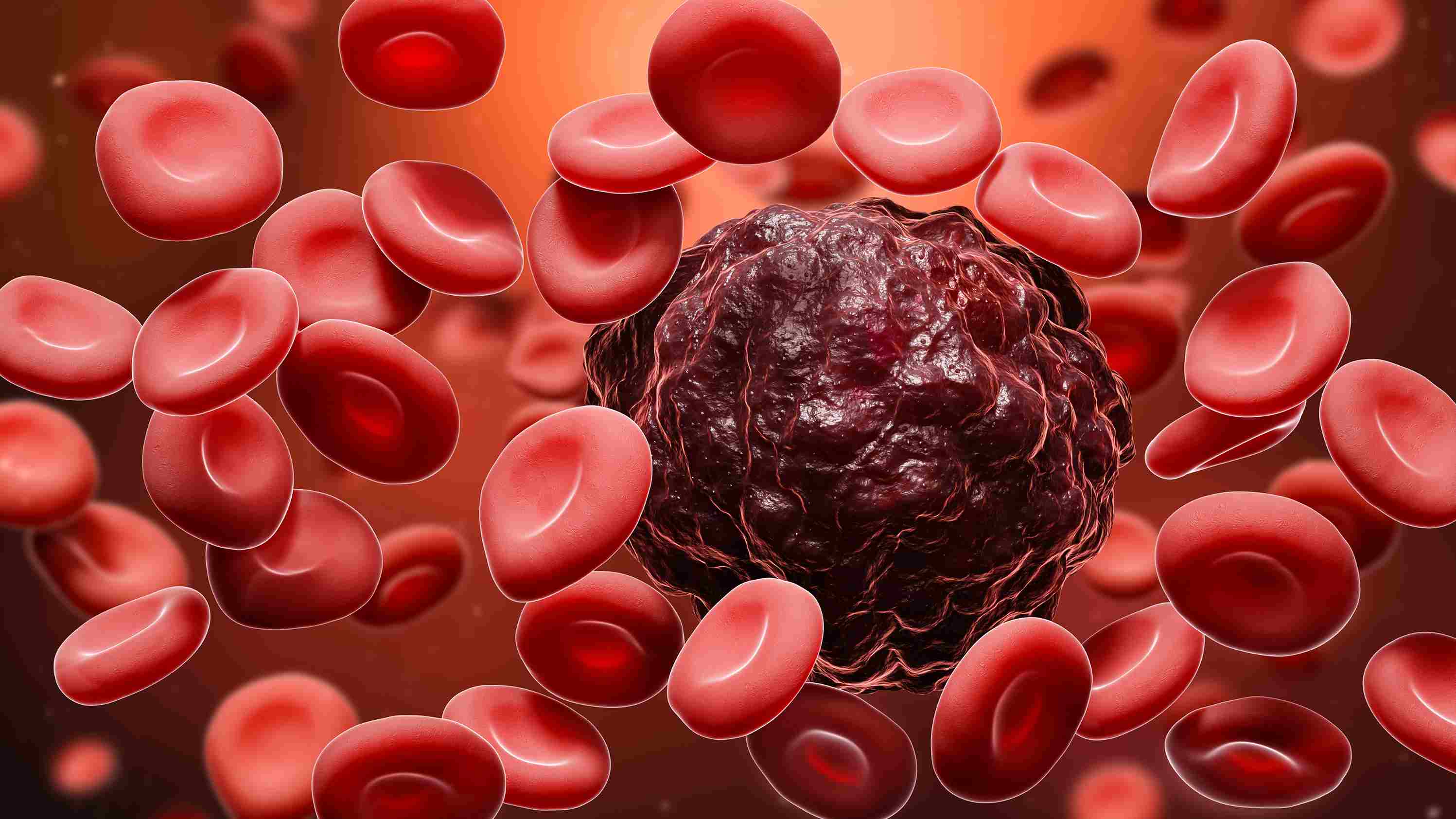 Blood Cancer Is A Disease