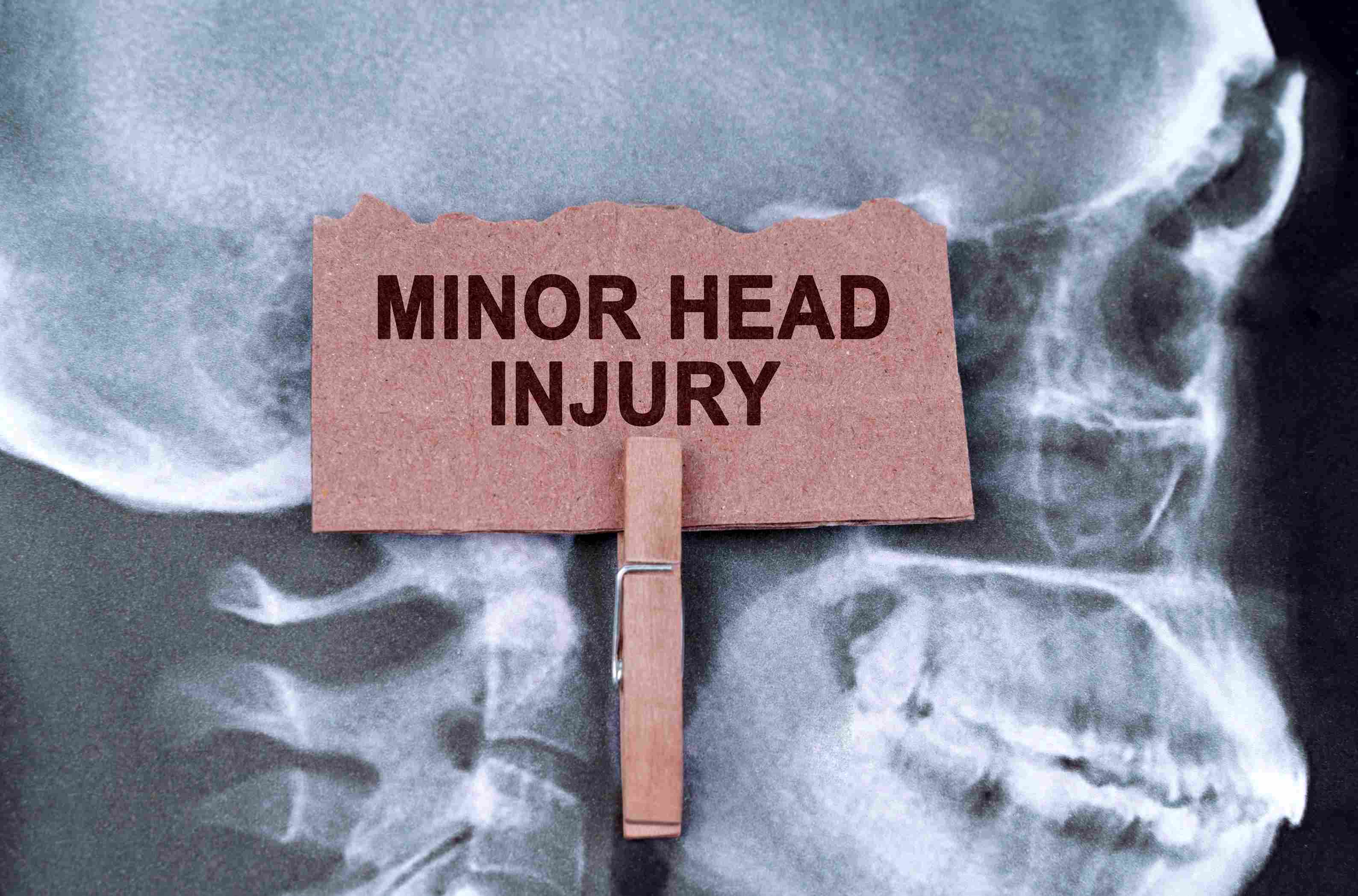 minor-head-injury-symptoms-causes-treatment-diagnosis-and-management