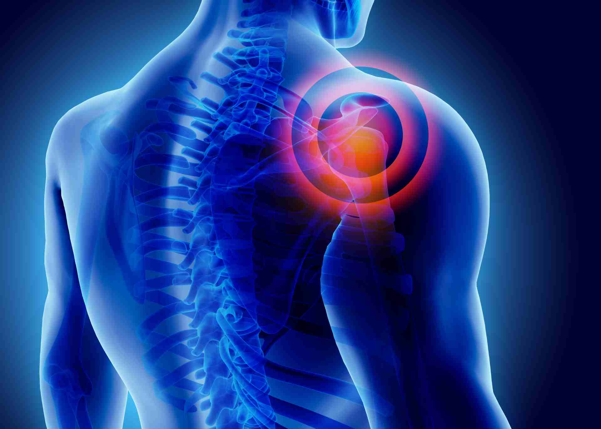 How To Relieve Shoulder Pain