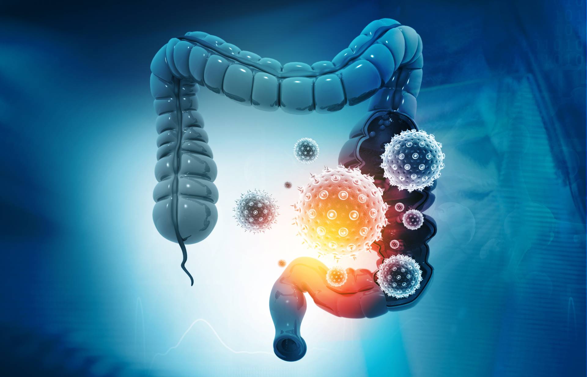 colon-cancer-symptoms-causes-and-treatment