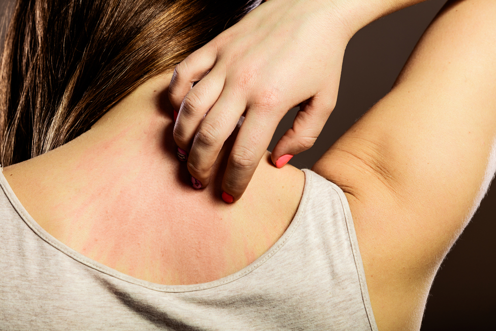 Skin Allergy: Symptoms, Causes and Treatment