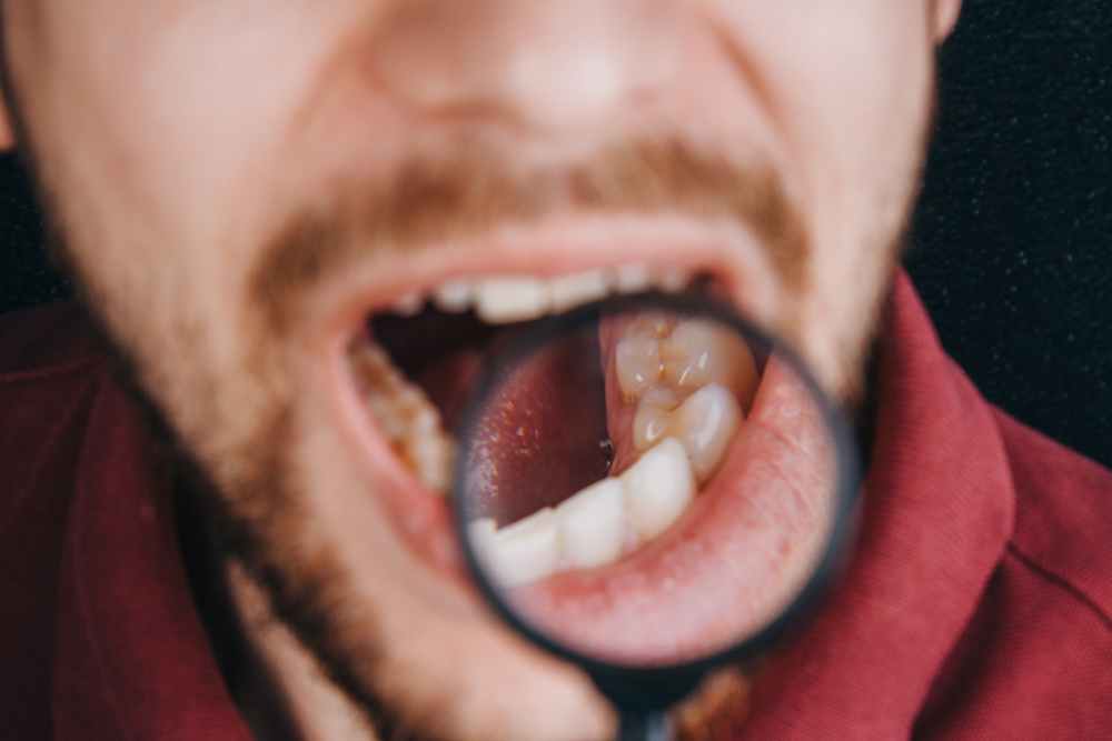 how-does-tobacco-destroy-your-oral-health-overall-being
