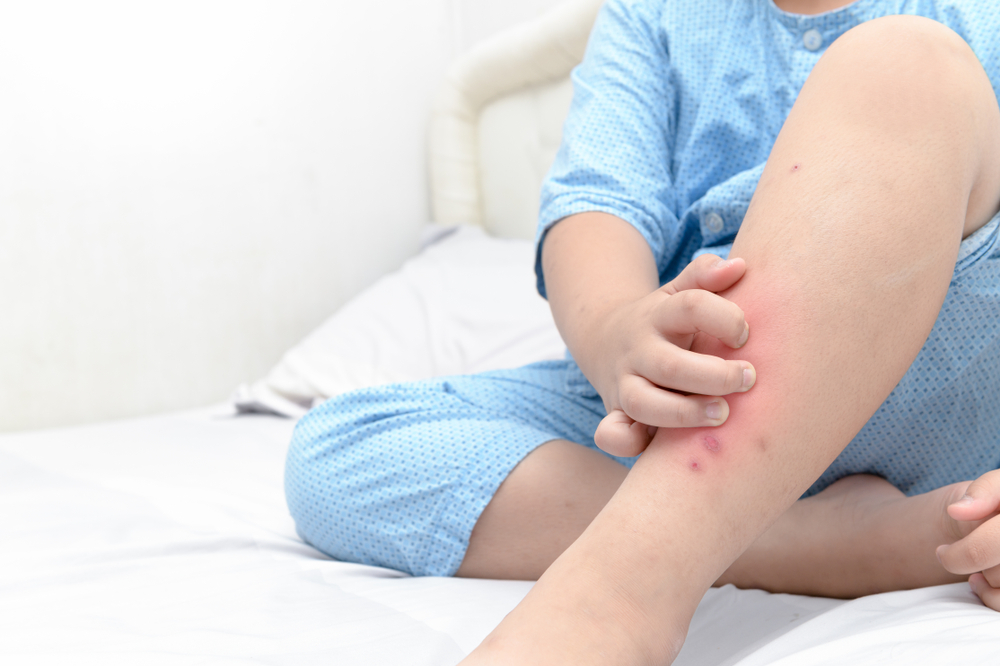 what-are-some-common-skin-infections-in-children