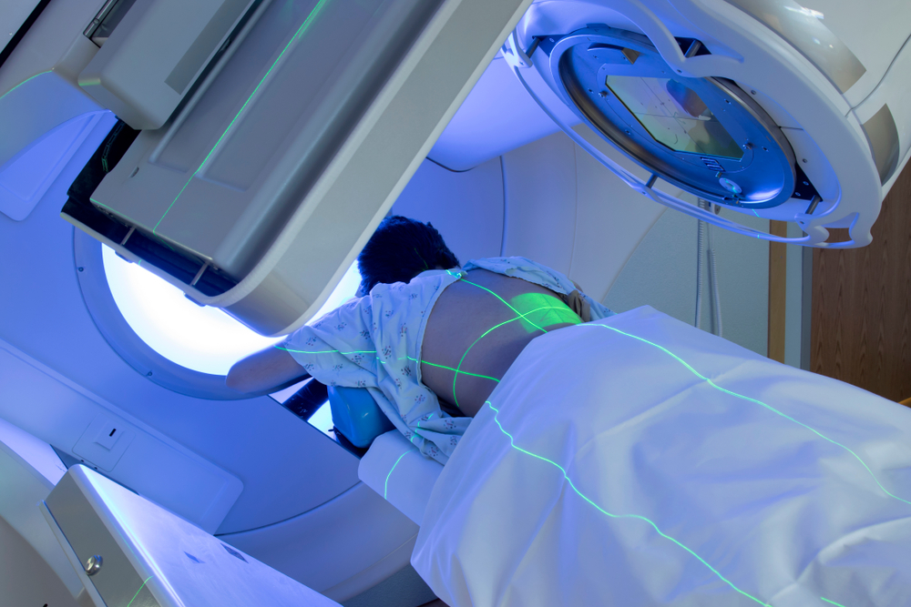 3d-conformal-radiation-therapy
