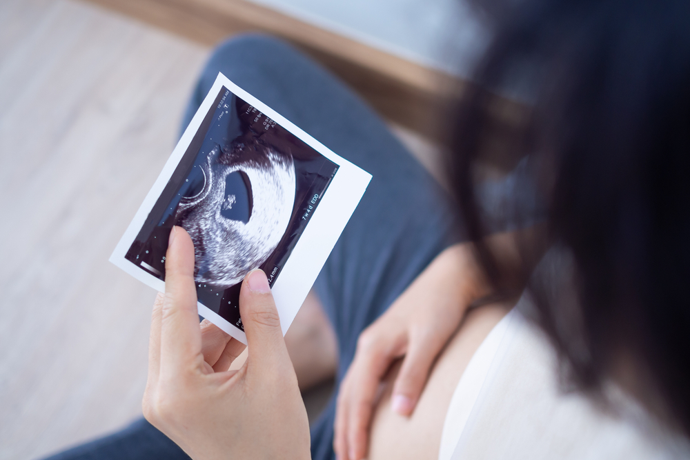 Seeing is Believing: The Incredible Journey of First Trimester Scans