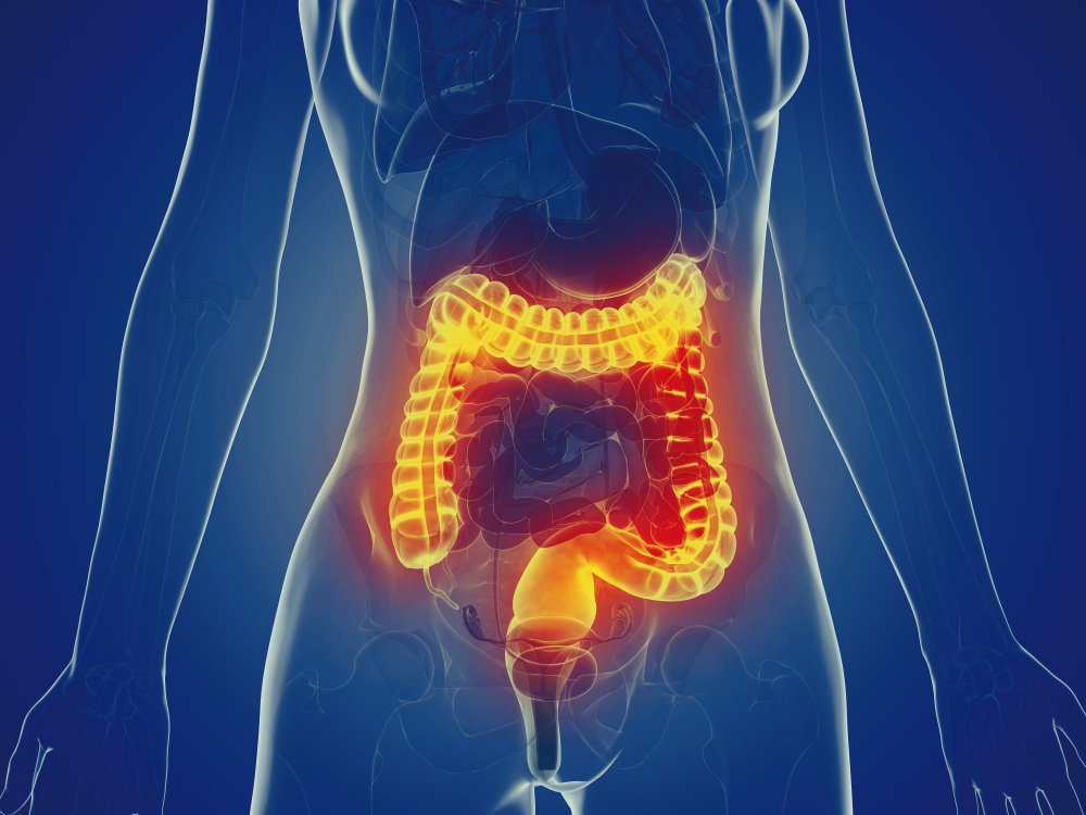 alternative-therapies-for-inflammatory-bowel-disease-examining-complementary-approaches