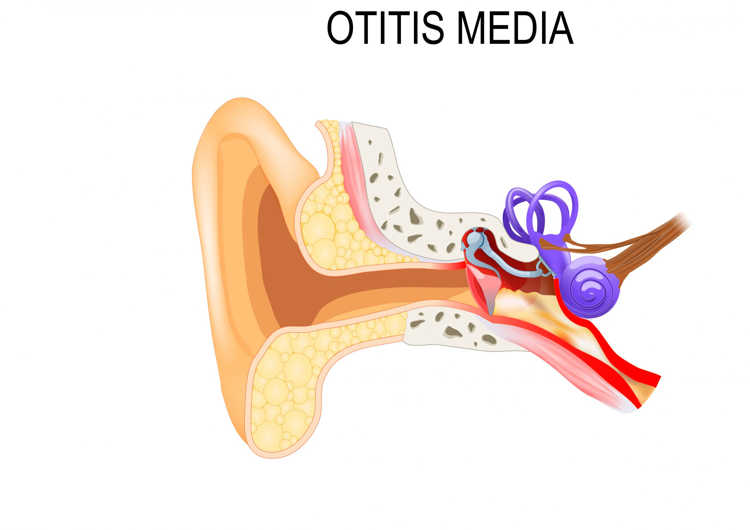 Ear Infections Causes Symptoms Treatment And Prevention Medanta 