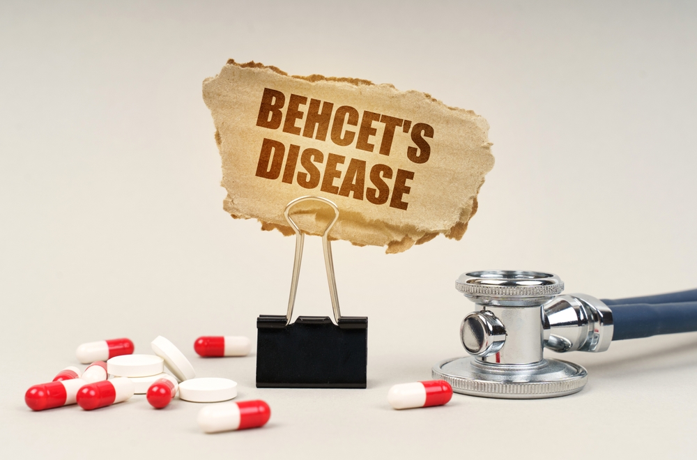 Behcet's Disease