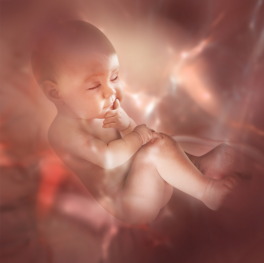 7 Impacts of Cystic Fibrosis on a Developing Foetus