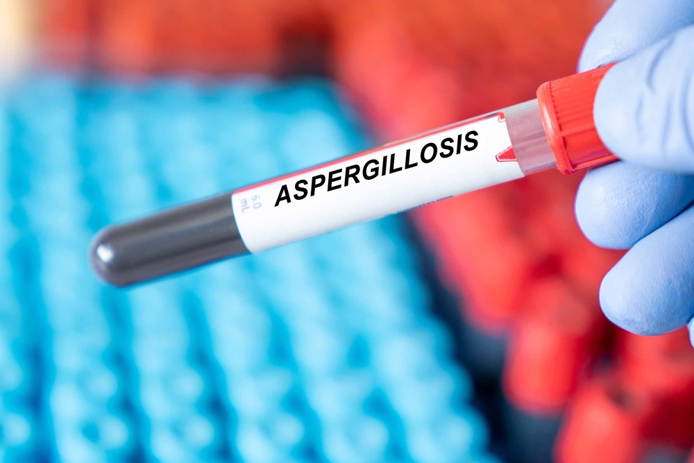 aspergillosis